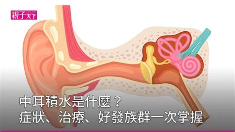 聽到水流聲|醫藥信箱╱單側中耳積水 可能是單純耳咽管問題